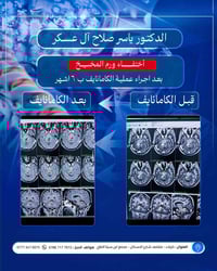 كامانايف • ورم المخيخ • كربلاء