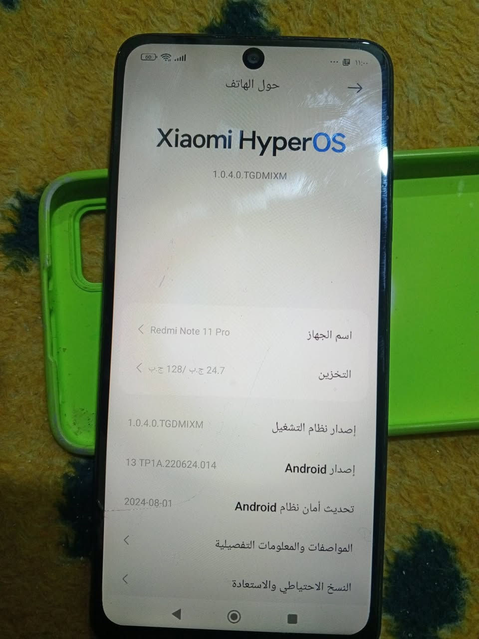 ريدمي نوت ١١برو ذاكره ١٢٨ جهاز بي فطر بشاشه  ضهره مفطر  جهاز سعره ٧٠ قفل مكاني ام النعاج رقمي ***********
