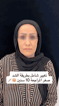 تغغير شامل بطريقة الشد 😍💉

بيد الدكتورة رواء الدليمي

@dr.rawaa.clinic

عيادات الدكتور قيس عبدالهادي قسم التجميل والحقن

فلر - بوتوكس - إبرة نظارة - ميزو وكل ما يخص التجميل

يمنا انتي اجمل

مواعيد دوام عيادات الدكتور قيس عبد الهادي يوميًا من الساعة 1:00 ظهرًا إلى الساعة 7:00 مساءً، عدا يوم الجمعة من الساعة 7:00 صباحًا إلى الساعة 1:00 ظهرًا

ديالى - شهربان - شارع البريد

للحجز، يرجى الاتصال مسبقًا على ***********

#فلر #بوتوكس #تجميل #ميزو #عيادة
