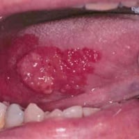 مجانا • مفصل الفك • كربلاء الجمعيه