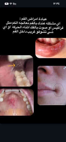 علاج جميع مشاكل الاسنان #مجاناً 

باستخدام احدث الاجهزه وبأشراف دكاتره اختصاص 

للحجز والاستفسار التواصل ع الواتساب ***********

العنوان /الحلة -شارع 40 - مجاور صيدليه سلامتك اولا - فندق الحياة سابقا
