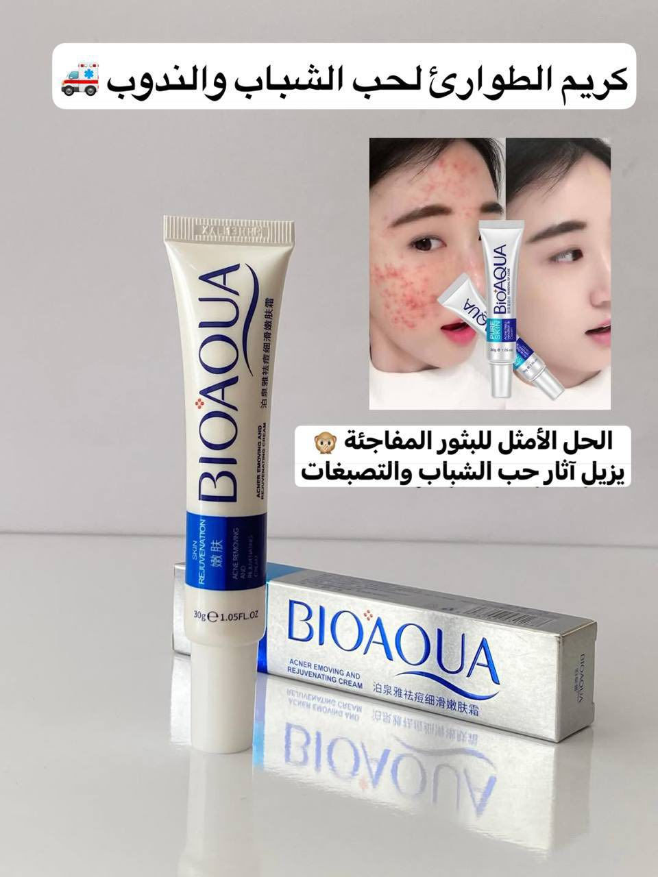 😍بكج بيو اكوا الجديد 😍

١- فوم غسول ضد الحبوب والبثور
✨ ينظّم إفراز الدهون بالبشرة
✨ يساعد بعلاج حبوب الوجه وآثارها
✨ مناسب للبشرة الدهنية والمختلطة
✨ ينظّف البشرة بعمق ويقلّل المسام الواسعة
✨ يرطّب وينعّم البشرة
✨ يساعد بتفتيح وتوحيد لون البشرة
✨ يقلّل البقع وآثار الحبوب
✨ ينقّي البشرة ويعطيها نضارة
✨ مناسب للبنات والشباب 💖

🌸 ٢- كريم ضد الحبوب
✨ يخفف الحبوب بسرعة
✨ يقلّل الرؤوس الحمراء والملتهبة
✨ يتحكم بدهون البشرة
✨ يرطّب ويغذي البشرة
✨ يساعد بمنع آثار الحبوب والبقع
✨ يفتح البشرة ويصلح التلف
✨ يحتوي على خلاصة الخيار 🥒 وزيت الزيتون 🫒 والكولاجين وفيتامين E
✨ يهدّي التهيج وآثار الشمس
✨ يساعد بتجديد البشرة وترميمها

💧 ٣- سيروم ضد الحبوب
✨ يحسّن مرونة البشرة
✨ يساعد بإصلاح البشرة المتضررة
✨ ضد الحبوب وآثارها والبقع
✨ ينظّم الدهون الزائدة
✨ ترطيب قوي ولمعة صحية للبشرة
✨ يساعد على التفتيح الطبيعي
✨ تركيبة نباتية وأورغانيك

سعر العرض 18الف


**إذا كنت صاحب هذا الإعلان وتريد حذفه لأي سبب، رجاءا أرسل رسالة إلى الدعم الفني**