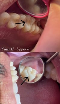 مجاني ١٠٠٪ • حشوات تجميلية • شارع 40