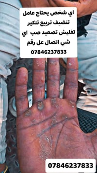 عامل تنظيف • تفليش • تصعيد