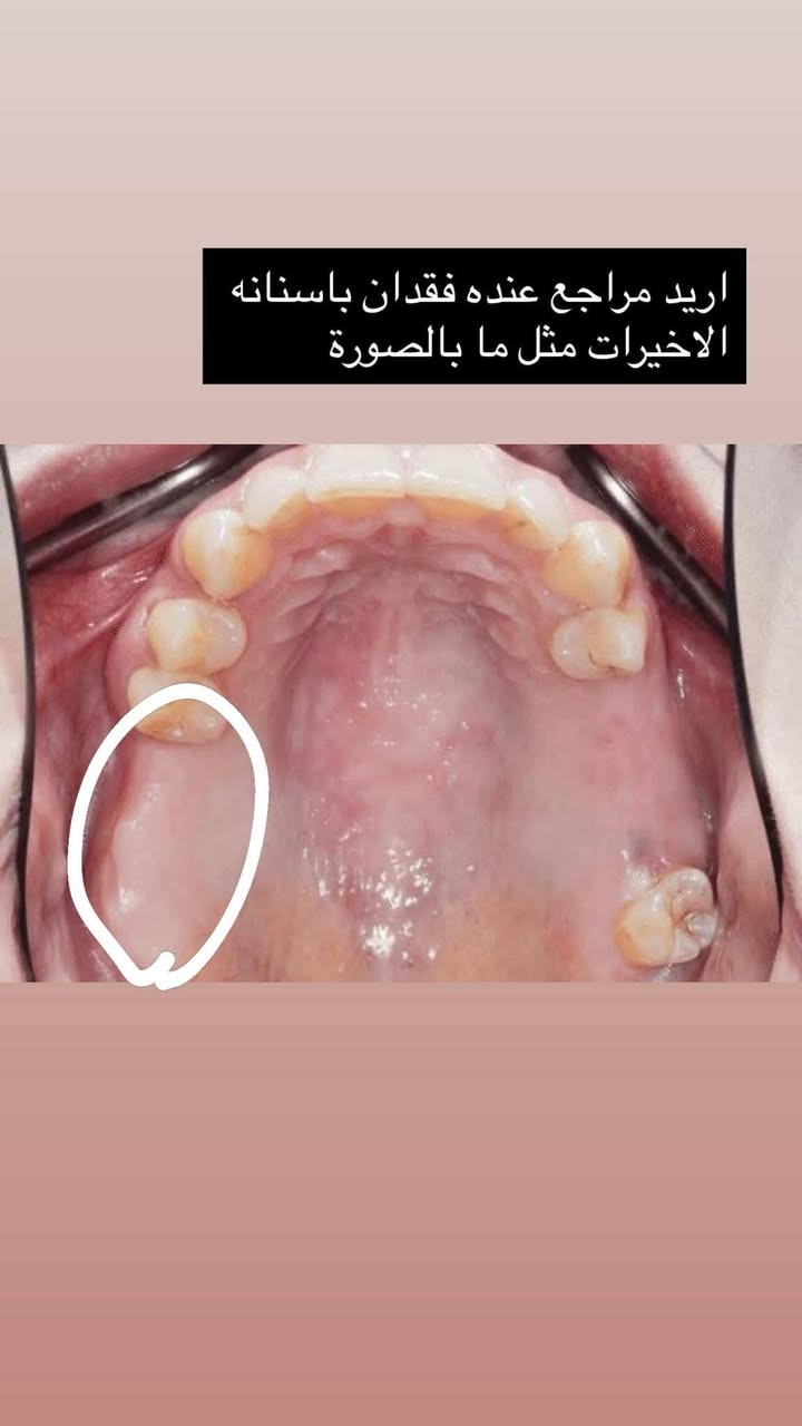 علاج مجانا 
تواصل واتساب ***********
