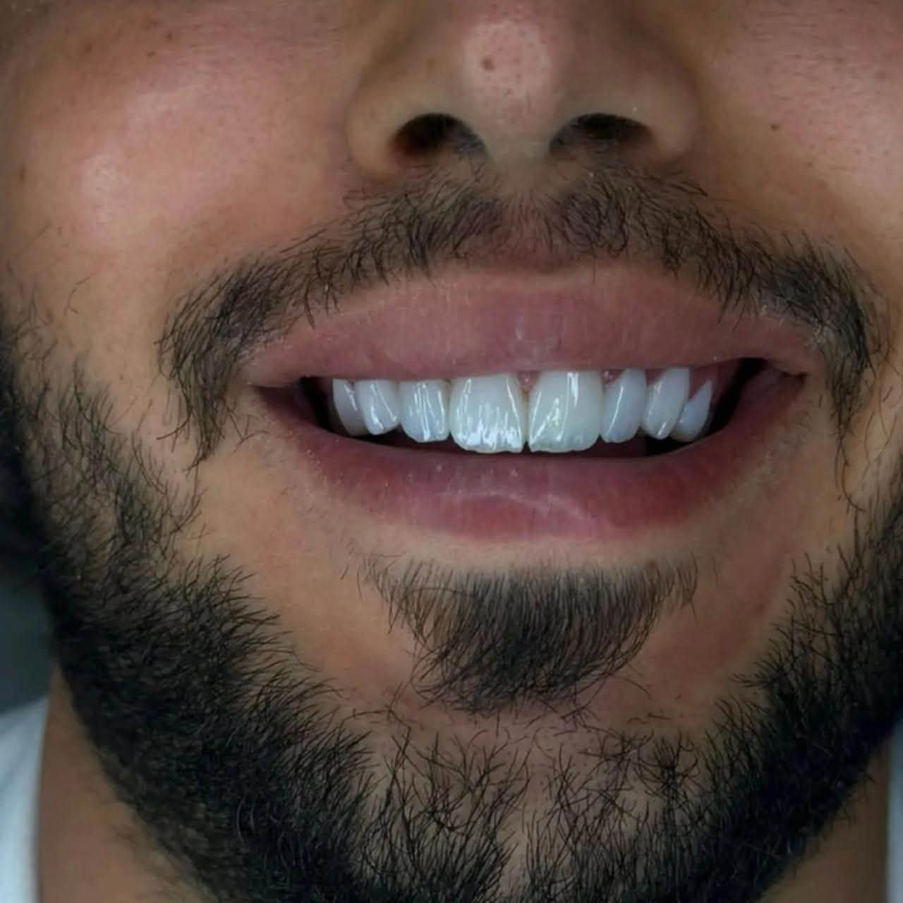 مركز ماسة الحسينية التخصصي لطب وجراحة الفم والأسنان 

متواجدين طيله ايام الأسبوع 
اهلا وسهلا ❤️

📍 الموقع: بغداد - الحسينية - خلف السوق الأول - شارع 20
📱 للاستفسار والحجز: ***********
