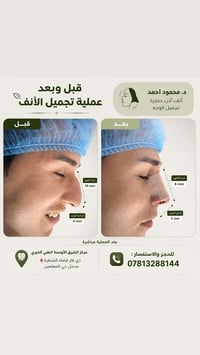 بعد العملية • مركز الشرق الاوسط • الشطرة