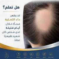 دكتورة جلدية • تجميل وليزر • الحويجة
