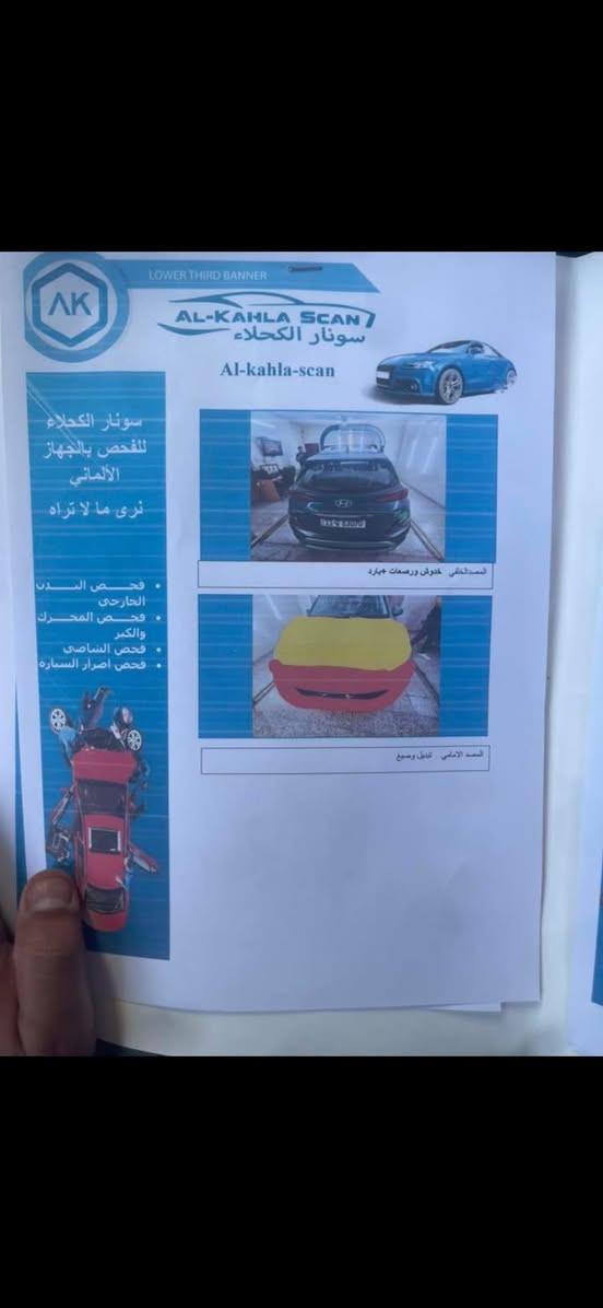 للبيع كونا موديل 2022 رقم بغداد بسمي فول الفول اعلى موصفات حادث جاملغ او بنيد سونر موجود بلمنشور شوفه زين رادارت اربعه توقف ذاتي من اربع جهات لايتات 3 عدسات سنو لد خلفيه امامي سلايت شاشه دجتل مكينه 1600 تيربو السعر 130ورقه


**إذا كنت صاحب هذا الإعلان وتريد حذفه لأي سبب، رجاءا أرسل رسالة إلى الدعم الفني**