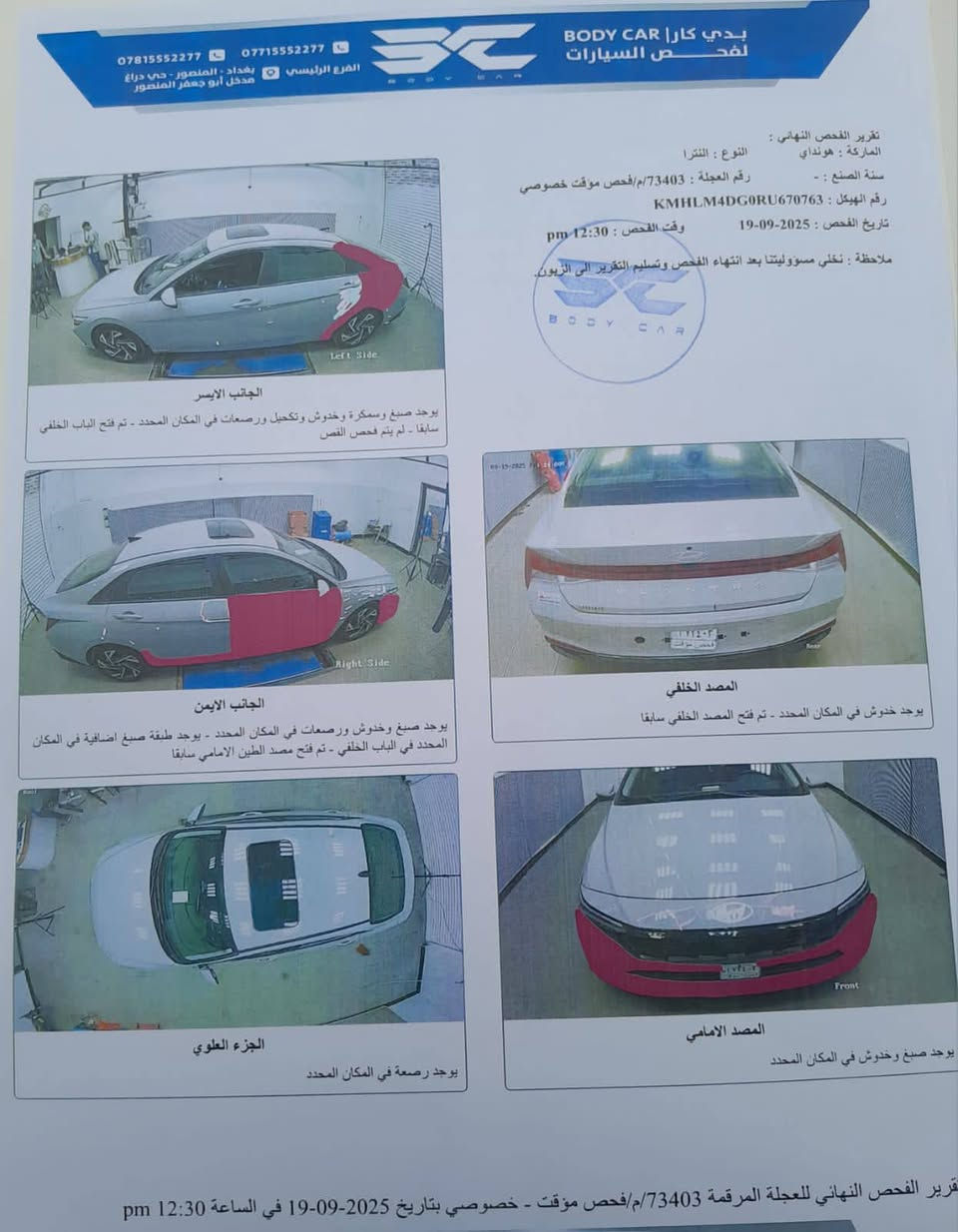 السلام عليكم صلي على محمد وآل محمد سيارة النترة موديل 2024 رقم بغداد المواصفات شاشة إلكترونية رادار امامي و خلفي امريكي محرك 2000 وقود السيارة بانزين السبير ما نازل و بصمة كير مكينة مكفول سونارهة كبالك العنوان بغداد الشعله قطاع 12 رقم الهاتف***********.
