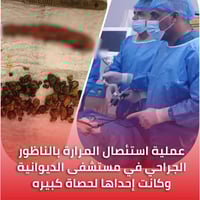 استئصال المرارة • ناظور جراحي • قضاء عفك