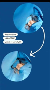 حشوات تجميلية • عيادات جامعة الزهراوي • طريق كربلاء-نجف عمود ١١١١