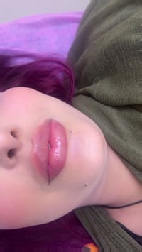 حقن فلر الشفاه👄 بطريقة ناعمة لمراجعتي الجميلة    الهدف من الحقن💉إبراز ...