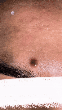 عيادة الامراض الجلديه والتجميل                 
                  الدكتور محمد محسن        
      اختصاصي الامراض الجلديه والتناسليه.                               #دكتوراه(بورد عربي).  
 #Mohamed Mohsen, MD l
اختصاص جراحةوتجميل الجلد   والليزر-بلازما-ميزو-تقشير كيميائي-بوتكس. 
#دبلوم عالي تخصص دقيق في تطبيقات الليزر الطبيه والبايلوجيه.
الرمادي -شارع الاطباء-مجاور صيدلية ابن سيناء-للحجز-***********
