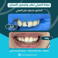 عيادة الهيتي • تجميل أسنان • الفلوجة