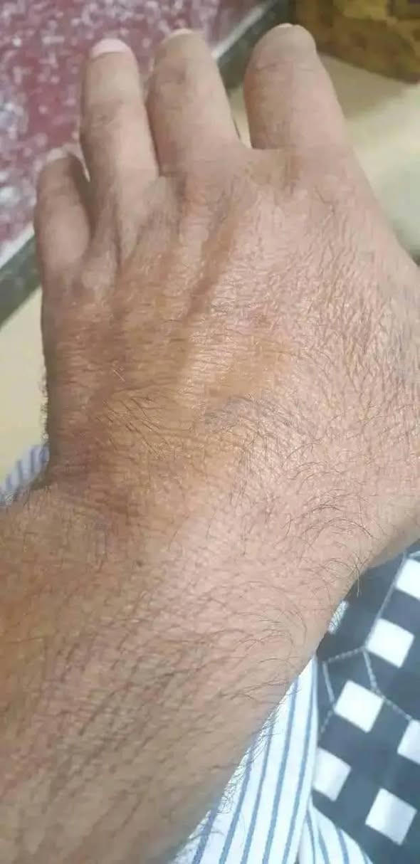 مستعدون لازالة جميع انواع الوشوم القديمة والحديثة بآحدث الأجهزة 
البصرة الجمهورية شارع الاطفاء مقابل ريتاج سنتر قرب حسينية البتول عليها السلام 
*********** ရန်ကုန်, ရန်ကုန်အရှေ့ပိုင်း
