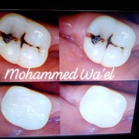 عيادة • طب أسنان • شارع 60