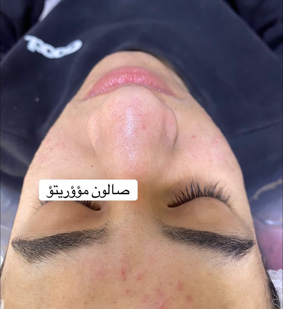 تعاني من الرؤوس السوداء والبشره الدهنيه🧏🏿🧏🏻

ماعليك بس تحجز 📞📞
ازاله الرووس السوداء 
التقشير المائي وازاله الدهون🧑🏻‍🔬
التقشير الكاربوني 🧔🏻‍♀️
للحجز مراسله الحساب او الاتصال 
***********📞
