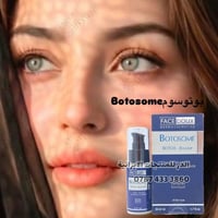 بوتوكس • شد الوجه • متوفر