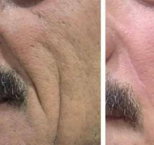 جلسات شد البشره وازاله التصبغات
بتقنية جديده 
للحجز او الاستفسار واتس
***********
