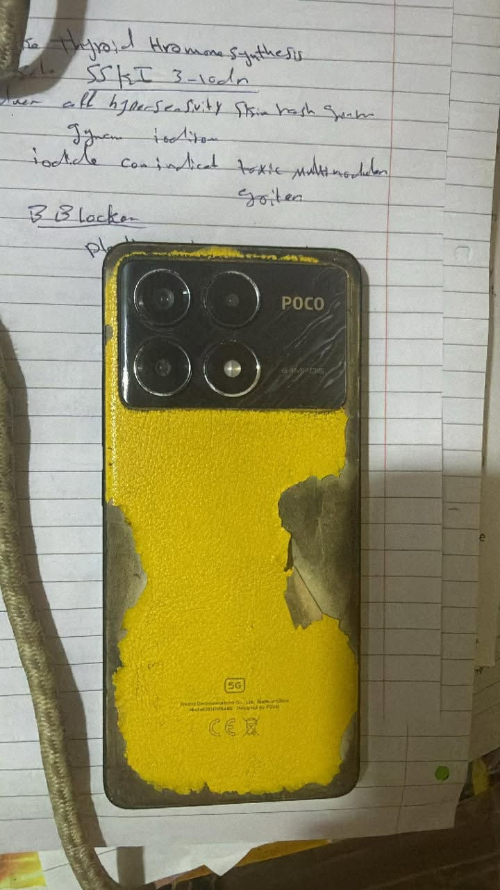 بوكو x6 برو ذاكره ٥١٦ مبدل شاشه للبيع السعر ١٢٥


**إذا كنت صاحب هذا الإعلان وتريد حذفه لأي سبب، رجاءا أرسل رسالة إلى الدعم الفني**