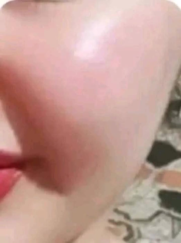 الف رحمة على امة وبي ليعلقلي هذا باب رزقي ❤شنو سويت وصارت بشرتي هيج
انا راح اكلجن الحل يلي تريد بشرة صافيه  وخالية من التجاعيد. والتصبغات والبقع والحب كتبي تم وانطيج العلاج النتيجة اسبوع تلاحظين فرق يخبل
#للحجز_والاستفسار_خاص


**إذا كنت صاحب هذا الإعلان وتريد حذفه لأي سبب، رجاءا أرسل رسالة إلى الدعم الفني**