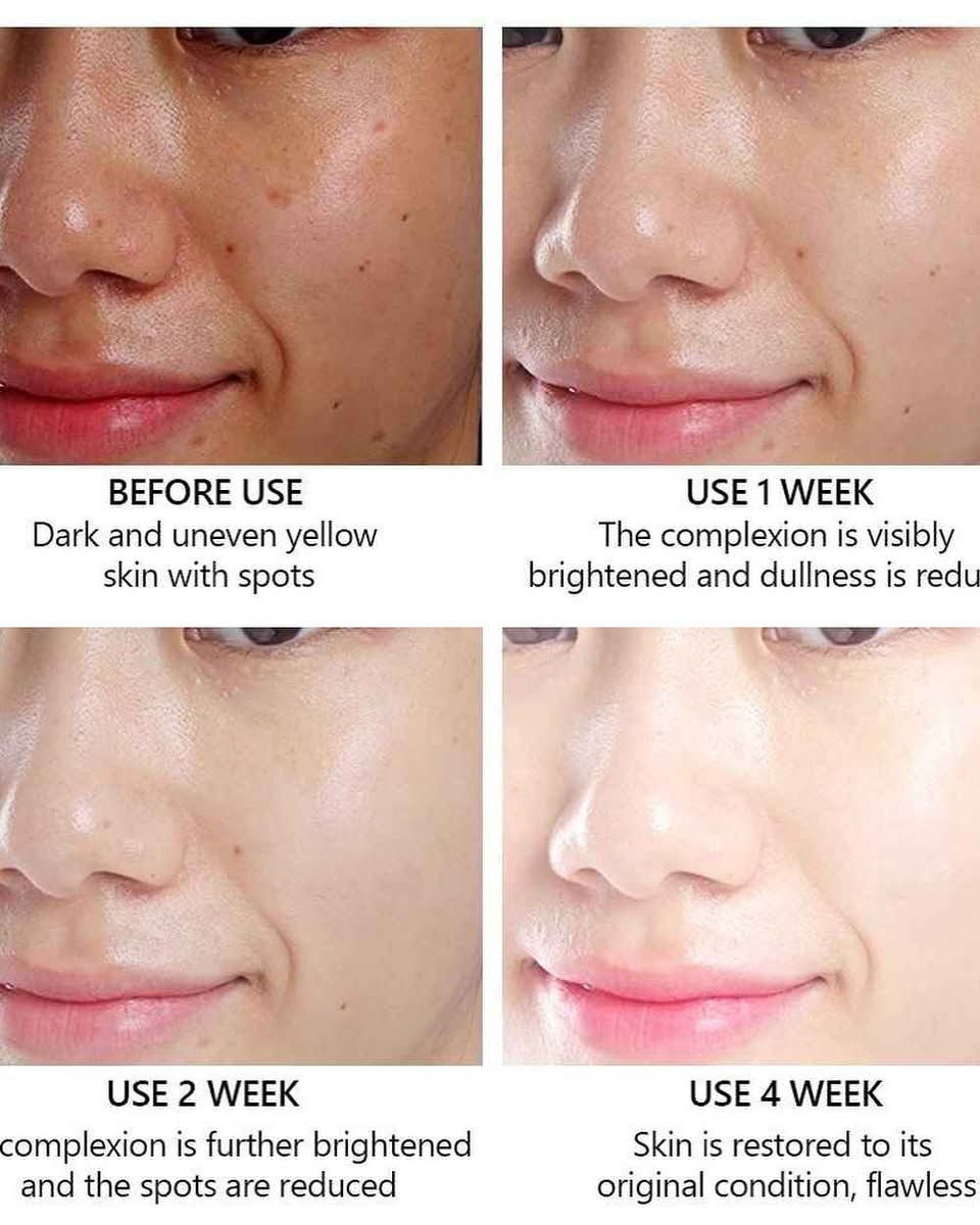 #سيروم_701 
جهزي بشرتك ووجهك للعيد 👌👌 وخلي الكل يسألك شنو مدايرة مع ❤❤❤❤

🚨🚨 سيروم  الكولاجين 😌😌
 
السيروم الخرافي 👌👌
 سيروم الكولاجين 🫶🏻🫶🏻مصل تفتيح الوجه بالكولاجين يتكون من الكولاجين وفيتامين A و E الذي يرطب ويشد البشرة ويقلل الخطوط الدقيقة على الوجه  مصل تفتيح الوجه بالكولاجين مع فيتامين سي👍  سيروم بتركيبة ناعمة غير لزجة تحتوي على تفتيح وكولاجين وفيتامين سي وغني بمكافحة الشيخوخة.  مع الاستخدام المنتظم ، يمكن أن يخفي المسام و التجاعيد الدقيقة على الوجه ويجعل بشرة الوجه تبدو مشرقة وصحية وناعمة.  طريقة الاستخدام: ضع 2-3 قطرات من السيروم على راحة اليد ثم ضعه على بشرة الوجه التي تم تنظيفها حتى خط العنق بالتساوي.  استخدمي السيروم قبل استخدام الكريمات أو مستحضرات التجميل الأخرى في الصباح والمساء بانتظام

سيروم #701 بغداد, العراق


**إذا كنت صاحب هذا الإعلان وتريد حذفه لأي سبب، رجاءا أرسل رسالة إلى الدعم الفني**