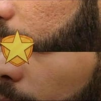 خلطة عشبية • طبيعية • توصيل لجميع المحافظات