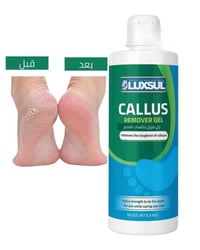 جل تكلسات القدم • LUXSUL • العزيزيه