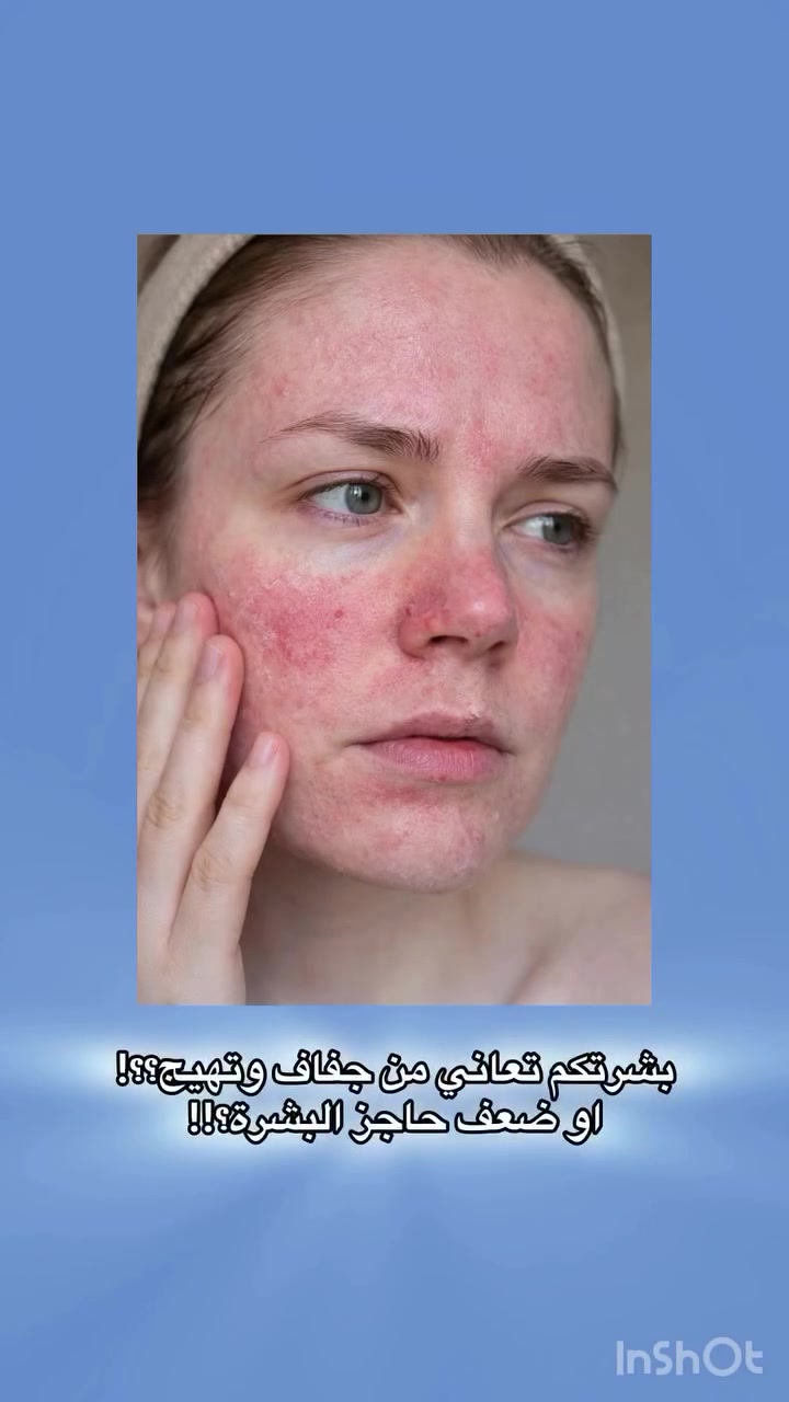 La Roche-Posay Cicaplast Baume B5+ 💙
البلسم المعالج اللي يشتغل بسرعة على ترميم البشرة ويرجعها ناعمة وهادية!

🌿 شنو يميزه؟
 • يعالج الجفاف والتشققات بسرعة
 • يهدّي الاحمرار والتهيج فوراً
 • مناسب للبشرة الحساسة وحتى بعد الليزر أو التقشير
 • بيه فيتامين B5 حتى يساعد على ترميم البشرة
 • خفيف وما يسد المسام

💧 من أول استخدام راح تحسين الفرق… بشرة أنعم، أهدأ، وصحية أكثر

✨ مناسب للوجه والجسم وحتى للأطفال

💊 صيدلية القمة البيضاء 💊
نهتم بصحتكم وجمالكم بكل التفاصيل 🌿

📍 العنوان:
بسماية – الشارع العام
مجاور فاملي ماركت وأمير أمزون


**إذا كنت صاحب هذا الإعلان وتريد حذفه لأي سبب، رجاءا أرسل رسالة إلى الدعم الفني**