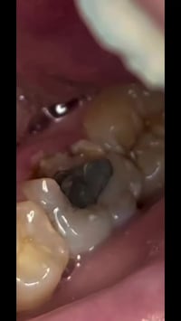 للحجز و الاستفسار 07733042763 #عيادة_الدكتور_حسنين_العلوان_لطب_الاسنان...