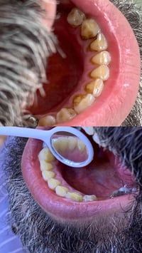 تنظيف اسنان مجاني • جامعة الكوفة • رخصة صاحب الكروب