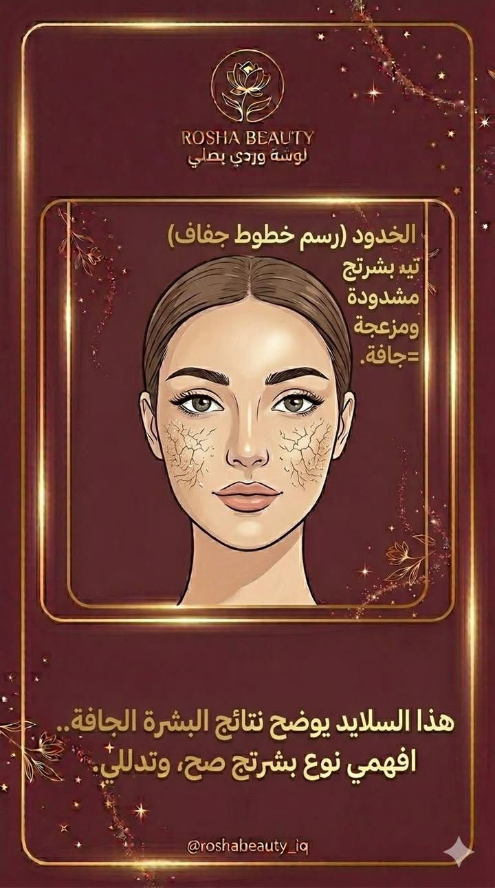 هواي بنات يراسلوني يسألون عن أفضل منتج، وجوابي دائماً يبدي
بسؤال: شنو نوع بشرتج؟ 🌸
​لأن اختيار المنتج الغلط ممكن يسبب مشاكل أحنا بغنى عنها،
 قررنا نبدي هذا الأسبوع برحلة اكتشاف لنفسج ولجمالج.
​الاختبار بسيط وما يحتاج غير ساعة من وقتج
افتحي الصور و اتبعي الخطوات 💕
#BeigLosha​#لوشة_بيوتي​#عناية_لوشة​#نوع_البشرة​#روتين_البشرة​#البشرة_الجافة​#البشرة_العادية #نضارة_البشرة​#عناية_بالبشرة​#جمالك_سيدتي


**إذا كنت صاحب هذا الإعلان وتريد حذفه لأي سبب، رجاءا أرسل رسالة إلى الدعم الفني**