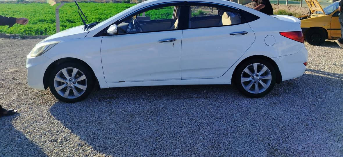 من رخصت الادمن
السلام عليكم ورحمة الله  اكسنت 2014 خليجي فول

فتحه + تحكمات+ كامره +تجوه +حساسات 

مكينه كير شرط  تخم تاير

باسمي تحويل ثاني يوم رقم قادسيه

الدولي لسنه 2029 

بيه بارد جاملغ الامامي الأيمن ٤ اصباع

وبيه رصعات حالوب جدا خفيفه  حتى بالصوره ممبين

وتقشير بالصبغ وتجي تفحص وين ما يعجبك

الي يعجبه يتصل والي ما تعجبه الله يرزقه بأحسن منه

السعر 95 وبيه مجال 

رقم الموبايل ***********
