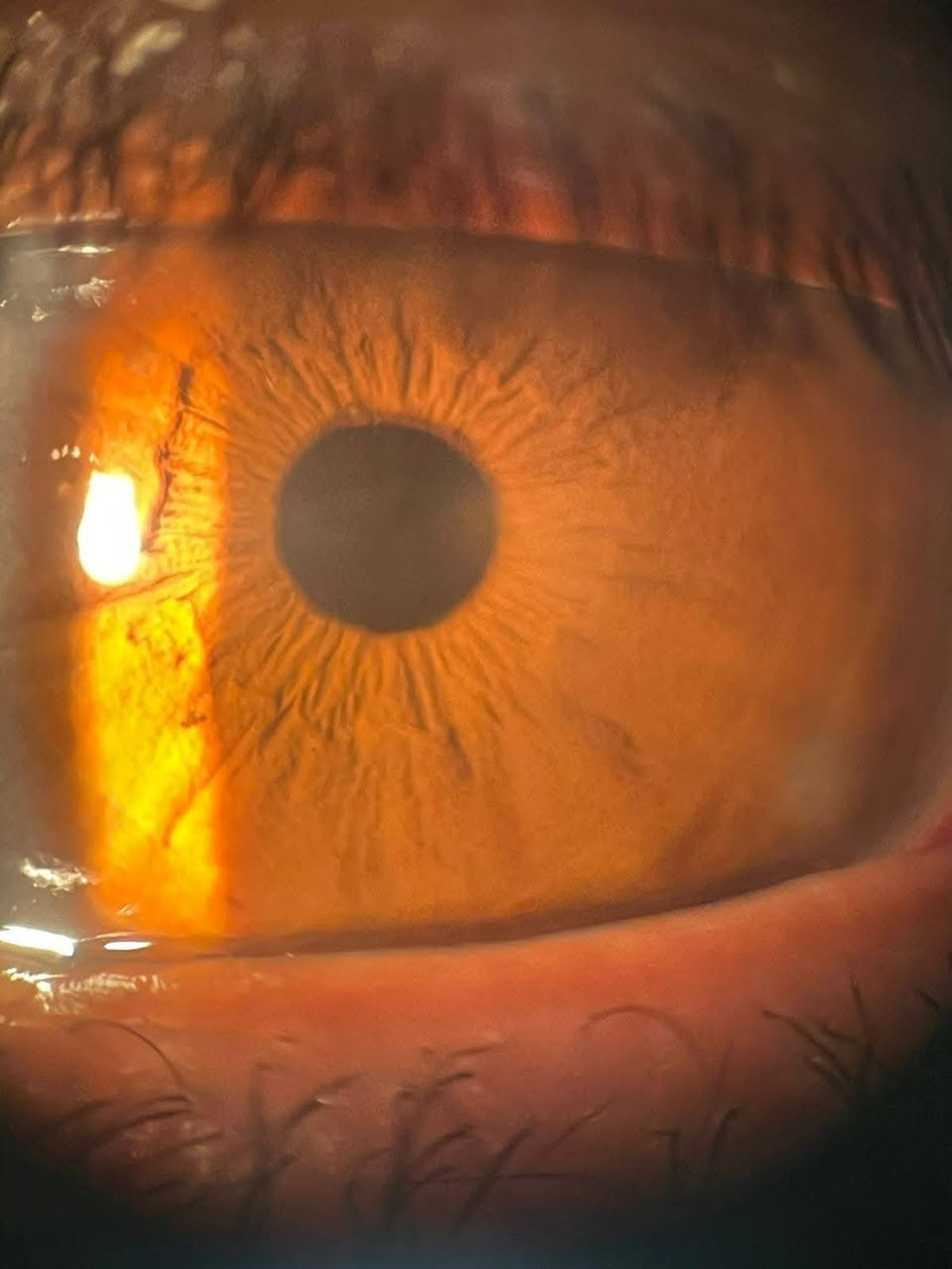 يُعلن الدكتور قاسم
اختصاصي طب وجراحة العيون
عن تواجده في عيادته
🗓 يوم الجمعه صباحا
📍 العنوان:
الحصوة – قرب مرطبات التفاحة الحمراء
مجمع عالم الطب التخصصي
📞 للحجز والاستفسار:
***********
