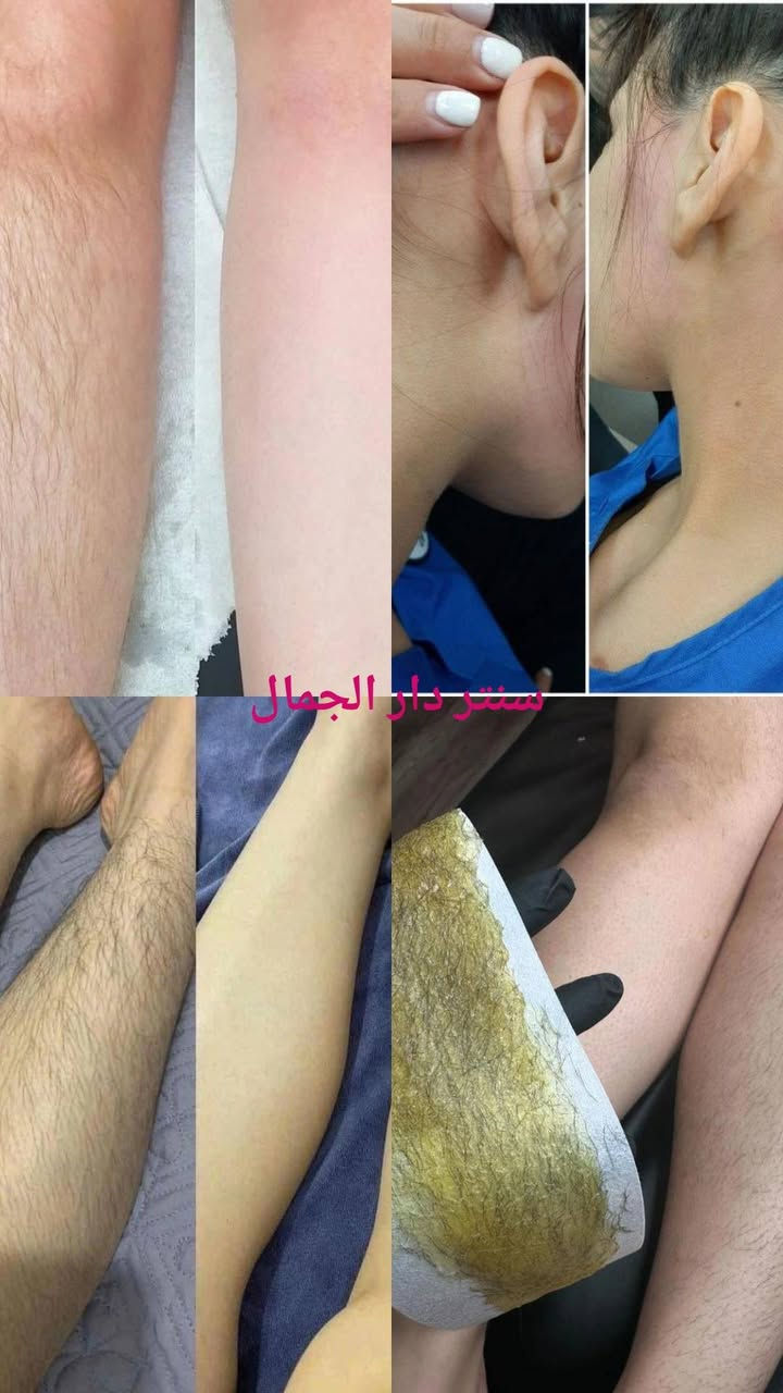 هلأ وسهلاً بكم بغداد العبيدي قرب سوق العبيدي فوق مصور زغاريد مقابيل صيدلية خضير سنتر دار الجمال *********** عروض لأول مره في سنتر دار الجمال تفليش كولشي بلاش
