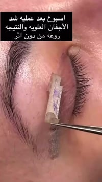 ✨🌙 عروض رمضان – عيادة الشهد للتجميل 🌙✨  بمناسبة شهر الخير، خصومات خاصة...