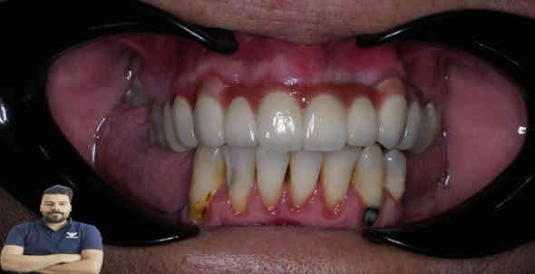 المراجعة جانت مسوية تركيب بغير عيادة فترة وواكع
لان الاسنان كلش تعبانة رجعنة بنينة الاسنان وسوينالهة تركيب سيراميك

العنوان / المسيب / شارع البلدية / مقابل دكتور جعفر وفي للاطفال

للحجز والاستفسار
***********
***********
