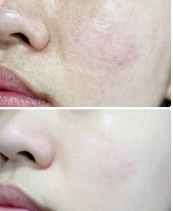 كريم تبيض نضاره للبشره
تتفتيح البشرة
حب شباب كلف نمش تصبغات
 ستخدم رجل نساء


**إذا كنت صاحب هذا الإعلان وتريد حذفه لأي سبب، رجاءا أرسل رسالة إلى الدعم الفني**