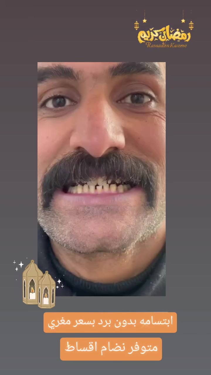 ✨  ابتسامة جديدة لأحد مراجعينا اليوم والنتيجة جداً مميزة
بمناسبة شهر رمضان المبارك 🌙
🔥 عروض خاصة على علاجات الأسنان والتجميل
🔥 نظام أقساط مريح ومناسب للجميع
🔥 أسعار مخفضة لفترة محدودة
لا تأجل علاجك… ابتسامتك تستاهل الأفضل
📍 الأمين الثانية – شارع المهداوي
***********
