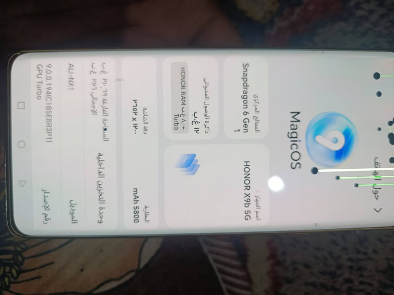 للبيع x9نضيف بي خيوط بشاشه ريدمي 14ذاكره 256


**إذا كنت صاحب هذا الإعلان وتريد حذفه لأي سبب، رجاءا أرسل رسالة إلى الدعم الفني**