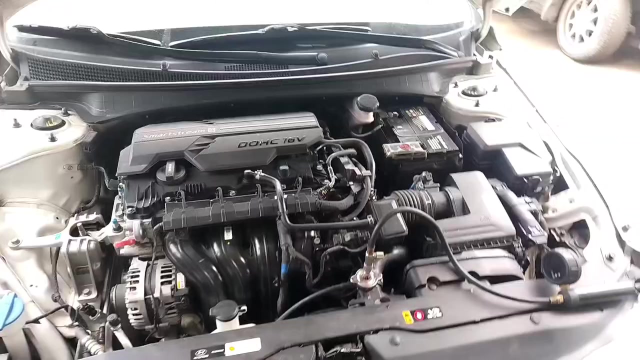 النترا 2024 تبديل ماء زيتي بلجهاز الألي
لاتنسون الايك والاشتراك بل قنات يوتيوب الاخوين
 راديترات ولصالنصات وغسل السلندر بجهاز الألي وتبديل ماء راديتر وفحص كازكيت ابحدث الاجهزه وتنظيف حجر بيئه شهداء البياع قرب جامع الكبيسي
📞***********

https://www.tiktok.com/@omui4?_r=1&_t=ZS-94b3BQsNcSC
تيك توك👆

https://youtube.com/shorts/PH2pS8JcwlE?si=wvivTdDwhoYukOow
يوتيوب 👆 

https://www.instagram.com/reel/DU03CgkjSqj/?igsh=MWU1YnE0aWczcWYwbA==

انستكرام 👆 

https://www.facebook.com/share/1DzAWBg4tY/

فيس بوك 👆
