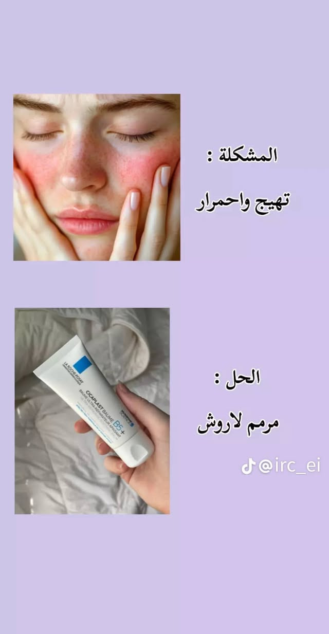 مرحبا عيني متوفر عندي مكياج شيكلام وعنايه اسعار كولش مناسبه ورخيصه الله شاهد للحجز خاص او رقم الواتساب ***********
 الي تحب تابعني عله صفحتي تيك توك واتشرف بيهه hnynbrand@
متوفر عندي توصيل جميع المحافضات
