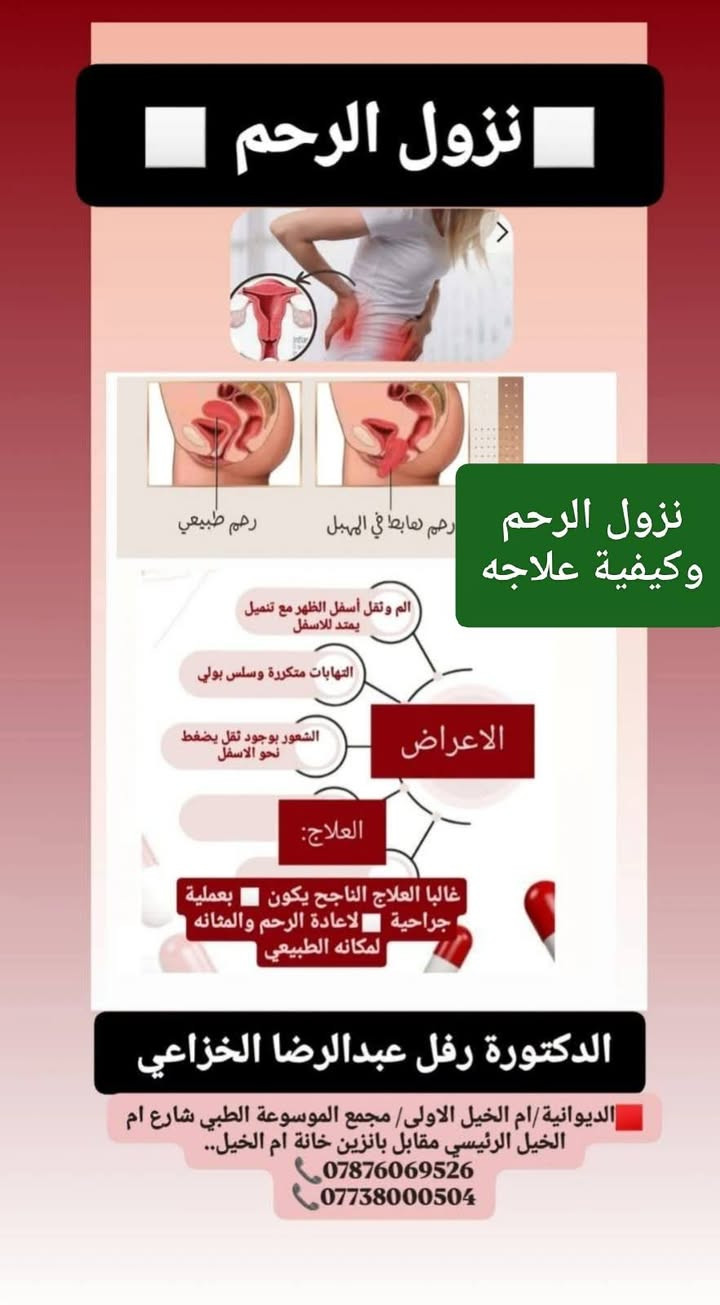 الدكتوره رفل عبدالرضا الخزاعي 👍
الدكتورة رفل عبدالرضا الخزاعي
طبيبة اختصاص /حاصلة على شهادة البورد العراقي🔻.
زميلة المجلس العراقي للاختصاصات الطبية 🔻 .
شهادة [الدكتوراه]🔻💪 بالجراحة النسائية والتوليد والعقم..
بكالوريوس طب وجراحة عامة🔻..
⏬⏬⏬
🩸اجراء كافة العمليات القيصرية المعقدة 💧وفك الالتصاقات..
🩸رعاية  الحوامل 💧و اجراء الولادة الطبيعية 💧داخل العيادة 👍
🩸علاج تكيس المبايض💧 وخربطة الهورمونات. 
🩸علاج حالات العقم💧 الأولي والثانوي والاسقاطات والمتكررة..
🩸اجراء التلقيح الصناعي💧 وتحديد جنس 💧 الجنين.
🩸إجراء عمليات التجميل💧 النسائية وتصحيح نزول الرحم والمثانة..
🩸اجراء عمليات السلس💧 البولي.
🩸اجراء عمليات استئصال الأورام السرطانية💧 للرحم والمبايض ..
🩸 اجراء عمليات قلع 👍الرحم والتليفات وأكياس المبيض بالناظور💧 ..
🟣🟣🟣🟣🟣🟣🟣🟣🟣🟣🟣🟣🟣🟣🟣🟣🟣
🟨الديوانية/ام الخيل الاولى🟨/ مجمع الموسوعة الطبي🟨 شارع ام الخيل الرئيسي مقابل بانزين خانة ام الخيل..
📞***********
📞***********🌹🌹🌹🌹🌹
