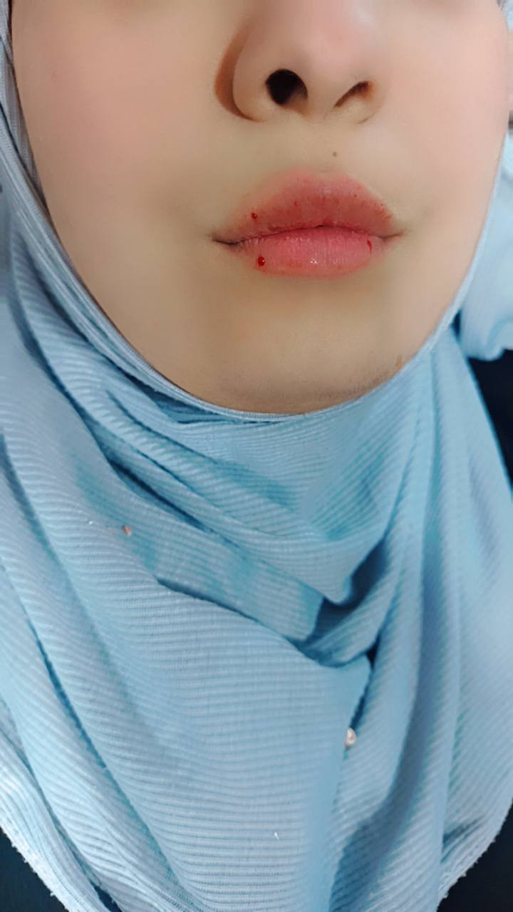 مستمرة عروض الفرررر


**إذا كنت صاحب هذا الإعلان وتريد حذفه لأي سبب، رجاءا أرسل رسالة إلى الدعم الفني**