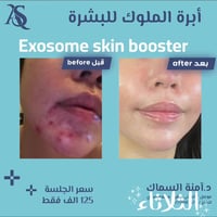 ابرة النضارة الملكية • دكتورة أمنة السماك • ناحية القيارة