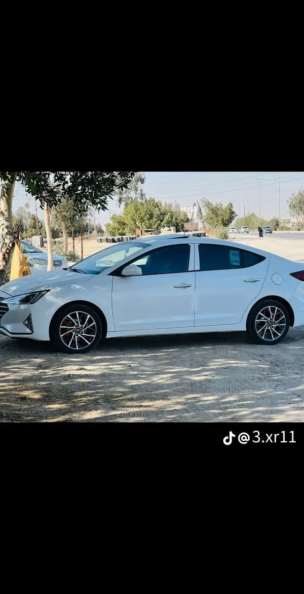 سياره النتره خليجي بسمي لبيع مديل 2020
ماشيه 145سياره جديده مكفوله كفاله عامه رقم بغداد انكليزي مكاني كربلاء طوريج ***********
السعر 170
