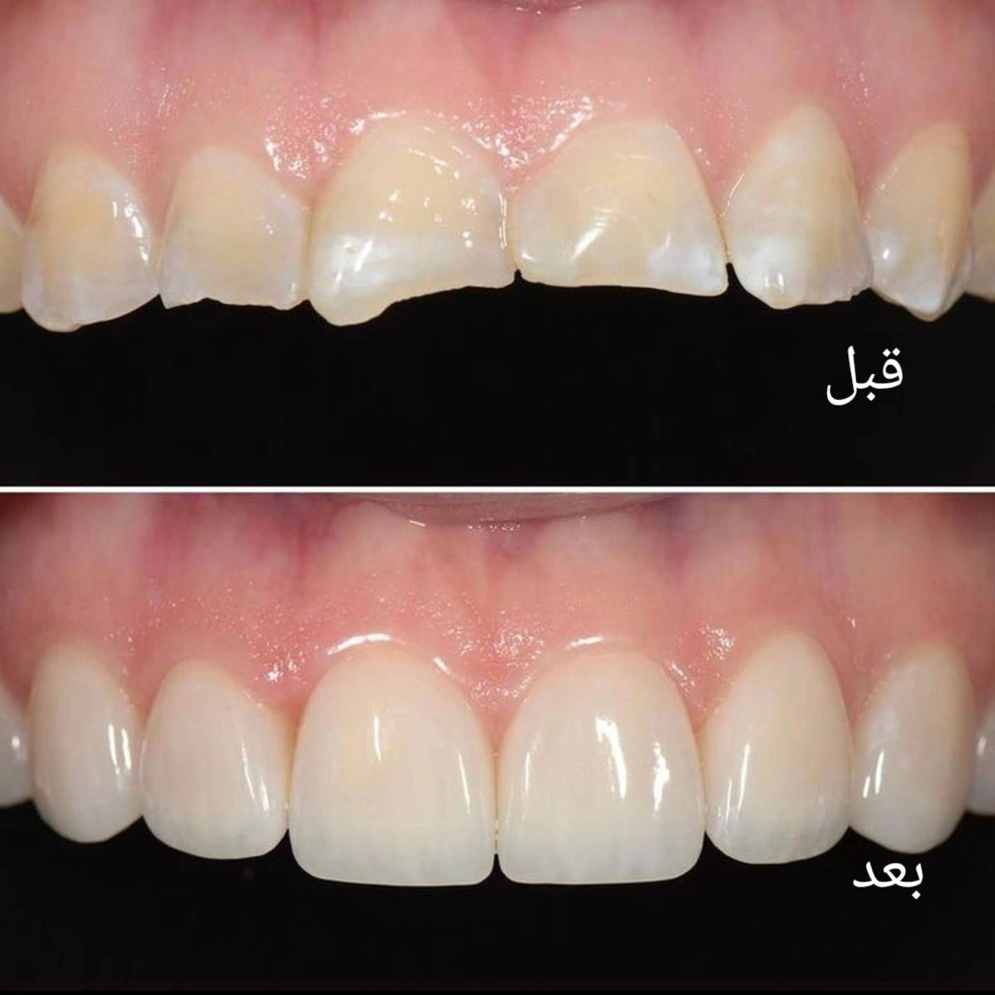 السلام عليكم نعلن عن توفير علاج للاسنان مجاني فقط لفترة اسبوع بعد العيد مباشرتا سارع في حجز موعدتك حشوات تنظيف قلع 
مجاني 
العنوان شارع فلسطين عيادات جامعه المصطفى خلف الجامعة المستنصرية قرب تقاطع الموال للحجز راسلونا على ***********
