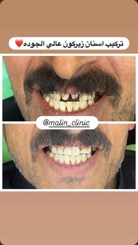 عيادة مالين • تجميل أسنان • سوق الشيوخ الإسماعيليه