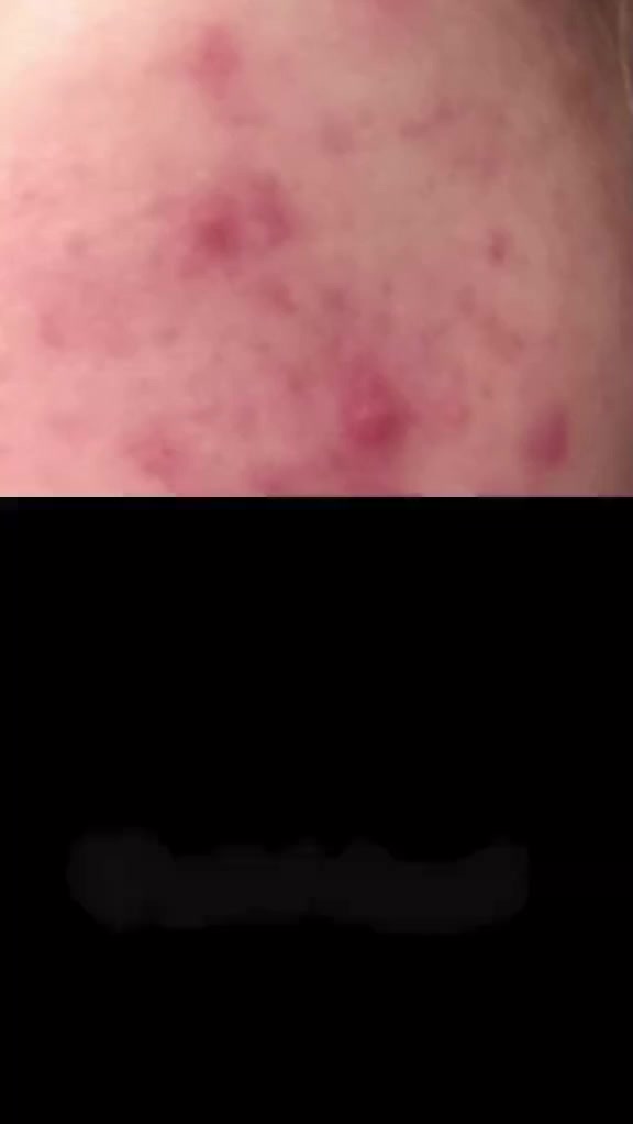 خلطة الملكية:

*الخلطة الملكية 👑 لتبييض ونضارة البشرة*  
تجربة فاخرة لبشرة براقة!  
✔️ تبييض فوري وتدريجي  
✔️ توحيد لون البشرة  
✔️ نضارة وإشراقة من أول استخدام  
مكوناتها طبيعية 100٪ من منتجات *Forever* 🍃  
—  
✨ متوفرة بكمية محدودة  
📩 احجزي خلطتك الآن وخلي بشرتك تـتـكلـم 💛


**إذا كنت صاحب هذا الإعلان وتريد حذفه لأي سبب، رجاءا أرسل رسالة إلى الدعم الفني**